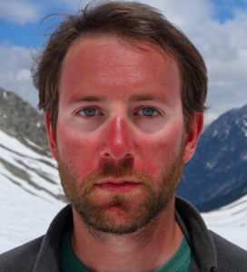 Портрет на мъж с леко зачервяване по лицето, стоящо на закрито, без слънчеви очила.